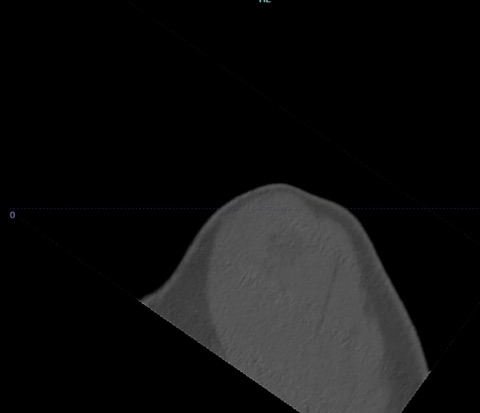 Oblique